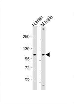 GBA2 Antibody in Western Blot (WB)