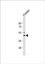 Kir2.1 (KCNJ2) Antibody in Western Blot (WB)