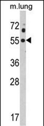 Kir2.1 (KCNJ2) Antibody in Western Blot (WB)