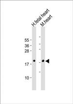 ANP Antibody in Western Blot (WB)