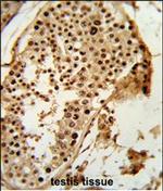 PARD3 Antibody in Immunohistochemistry (Paraffin) (IHC (P))