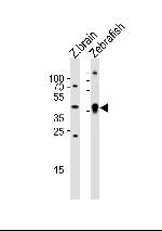 Adenosine Deaminase Antibody in Western Blot (WB)