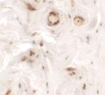 UPK1B Antibody in Immunohistochemistry (Paraffin) (IHC (P))