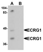 TMPRSS11A Antibody in Western Blot (WB)