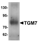 TGM7 Antibody in Western Blot (WB)