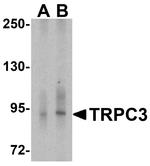 TRPC3 Antibody in Western Blot (WB)