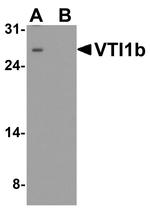 VTI1B Antibody in Western Blot (WB)