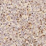 TRIP Antibody in Immunohistochemistry (Paraffin) (IHC (P))