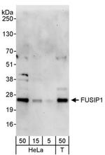 FUSIP1 Antibody in Western Blot (WB)