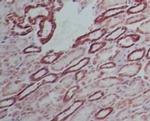 SAMHD1 Antibody in Immunohistochemistry (Paraffin) (IHC (P))