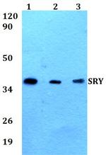 SRY Antibody in Western Blot (WB)