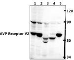 AVPR2 Antibody in Western Blot (WB)