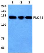 PLCB2 Antibody in Western Blot (WB)