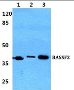 RASSF2 Antibody in Western Blot (WB)