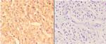 ABCC11 Antibody in Immunohistochemistry (Paraffin) (IHC (P))