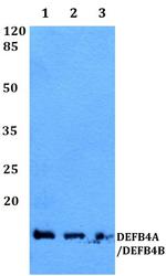 beta-2 Defensin Antibody in Western Blot (WB)