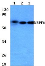 NBPF6 Antibody in Western Blot (WB)