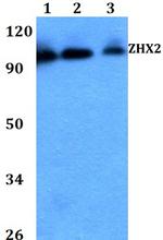 ZHX2 Antibody in Western Blot (WB)