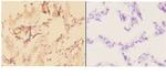 ADAMTS10 Antibody in Immunohistochemistry (Paraffin) (IHC (P))