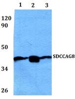 SDCCAG8 Antibody in Western Blot (WB)