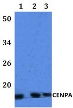 CENPA Antibody in Western Blot (WB)