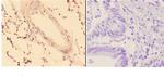 ACOT9 Antibody in Immunohistochemistry (Paraffin) (IHC (P))