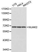 NUAK2 Antibody in Western Blot (WB)