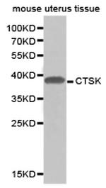 Cathepsin K Antibody in Western Blot (WB)