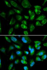 KIR2DL3 Antibody in Immunocytochemistry (ICC/IF)