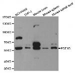 PDE1B Antibody in Western Blot (WB)