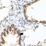 C8orf4 Antibody in Immunohistochemistry (Paraffin) (IHC (P))