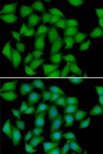 ATOX1 Antibody in Immunocytochemistry (ICC/IF)