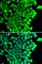 TRIAP1 Antibody in Immunocytochemistry (ICC/IF)