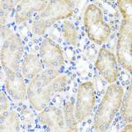 PSTPIP1 Antibody in Immunohistochemistry (Paraffin) (IHC (P))