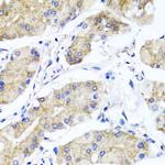 PSTPIP1 Antibody in Immunohistochemistry (Paraffin) (IHC (P))