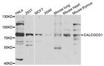 CALCOCO1 Antibody in Western Blot (WB)