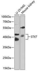 STX7 Antibody in Western Blot (WB)