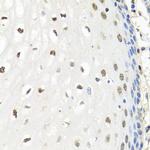 CNOT8 Antibody in Immunohistochemistry (Paraffin) (IHC (P))