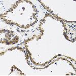 CALCB Antibody in Immunohistochemistry (Paraffin) (IHC (P))