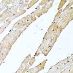 CALCB Antibody in Immunohistochemistry (Paraffin) (IHC (P))