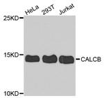 CALCB Antibody in Western Blot (WB)