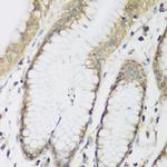 METTL7A Antibody in Immunohistochemistry (Paraffin) (IHC (P))