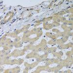 ATAD3B Antibody in Immunohistochemistry (Paraffin) (IHC (P))