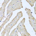 ATAD3B Antibody in Immunohistochemistry (Paraffin) (IHC (P))