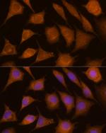 Cathepsin C Antibody in Immunocytochemistry (ICC/IF)