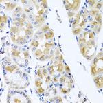 TMEM43 Antibody in Immunohistochemistry (Paraffin) (IHC (P))