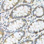 GNE Antibody in Immunohistochemistry (Paraffin) (IHC (P))