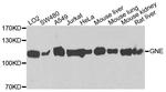 GNE Antibody in Western Blot (WB)