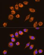 NAGA Antibody in Immunocytochemistry (ICC/IF)