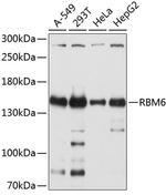 RBM6 Antibody in Western Blot (WB)